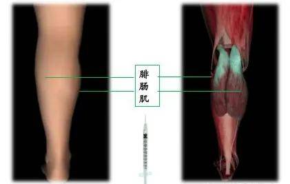 最有效的瘦腿方法（瘦腿的有效方法都有哪些？）-4