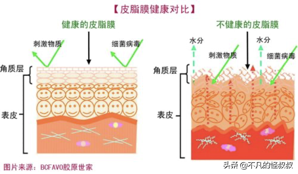 敏感肌应该做好哪些护理？