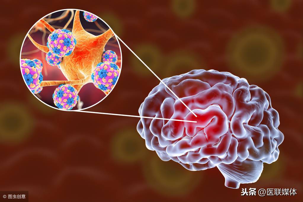 脑炎后遗症很可怕？唯有靠这5个办法，就算效果不如人意