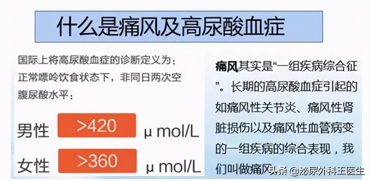 3种“碱性食物”，对排出尿酸有利，建议高尿酸患者要常吃