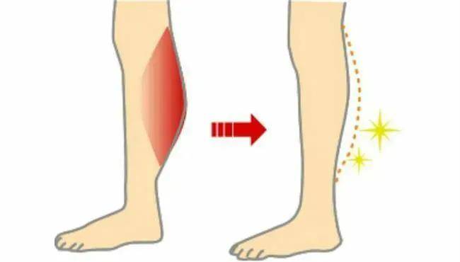 最有效的瘦腿方法（瘦腿的有效方法都有哪些？）-2