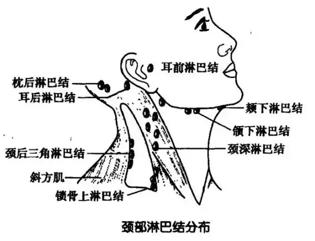 为什么要做淋巴排毒？