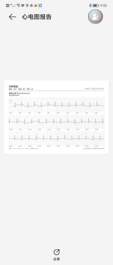 华为手表怎么重新配对新手机（华为手表取消配对后怎么重新配对）