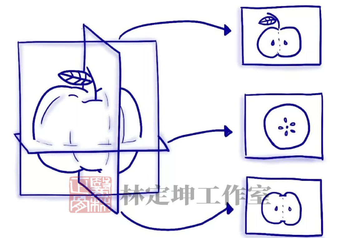 mri是什么检查项目（磁共振现在多少钱）